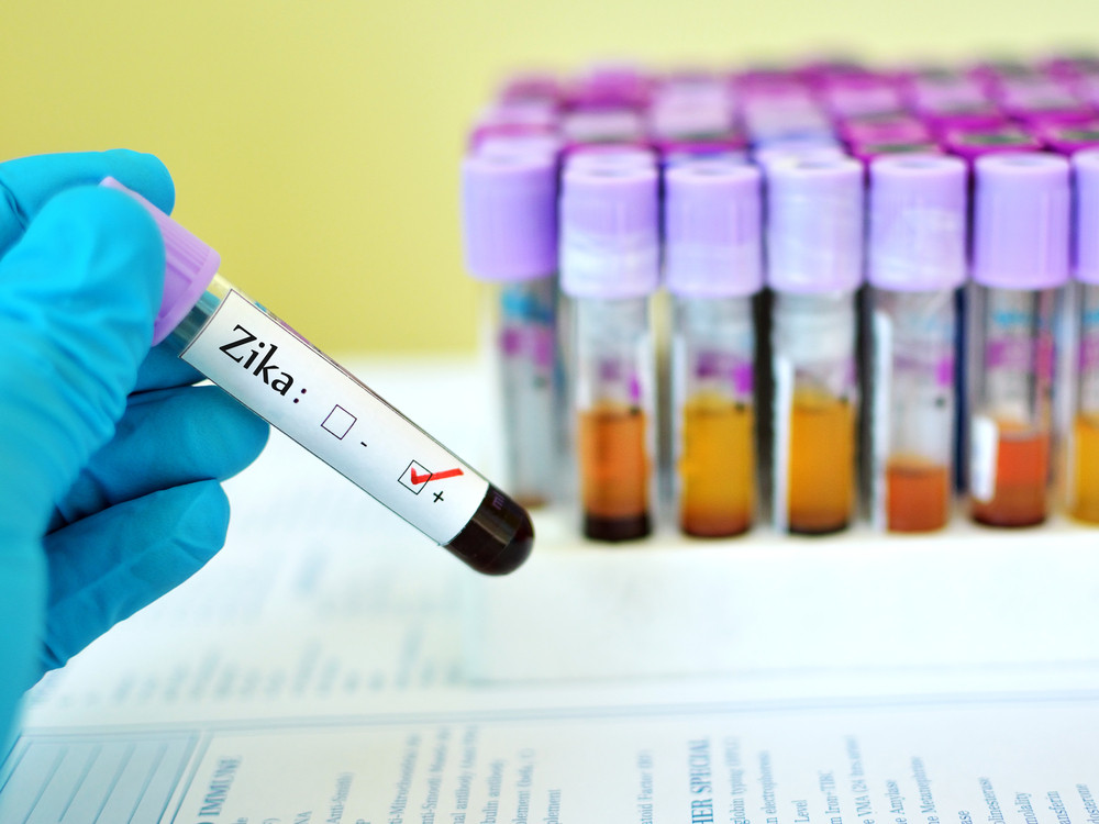 rougeole vaccin épidémie