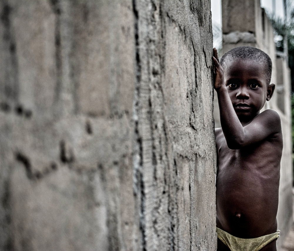 Malnutrition