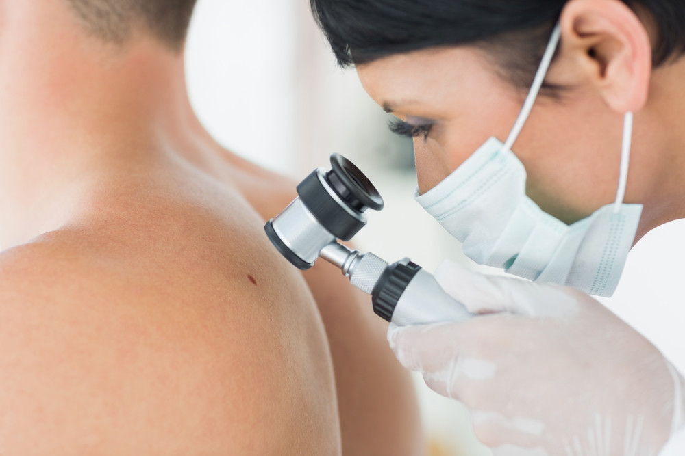 Un ordinateur a été meilleur que des dermatologues pour repérer les cancers de la peau