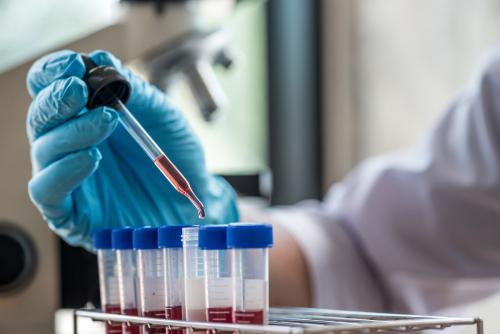Un test sanguin pour Alzheimer