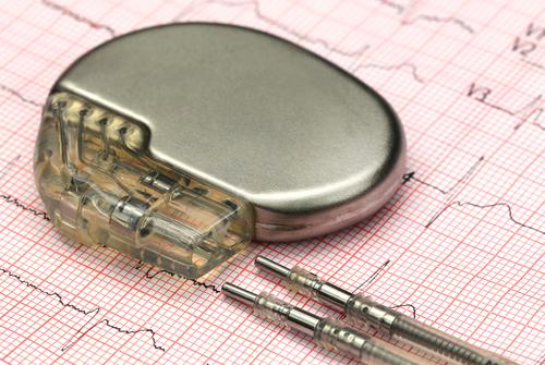 pacemaker 