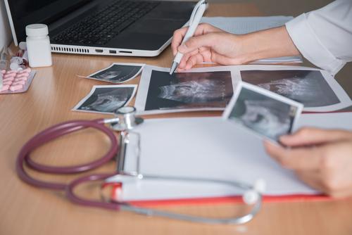 Des délais d'attente allongés pour les IRM et les scanners (c) Shutterstock