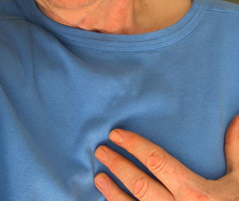 infarctus