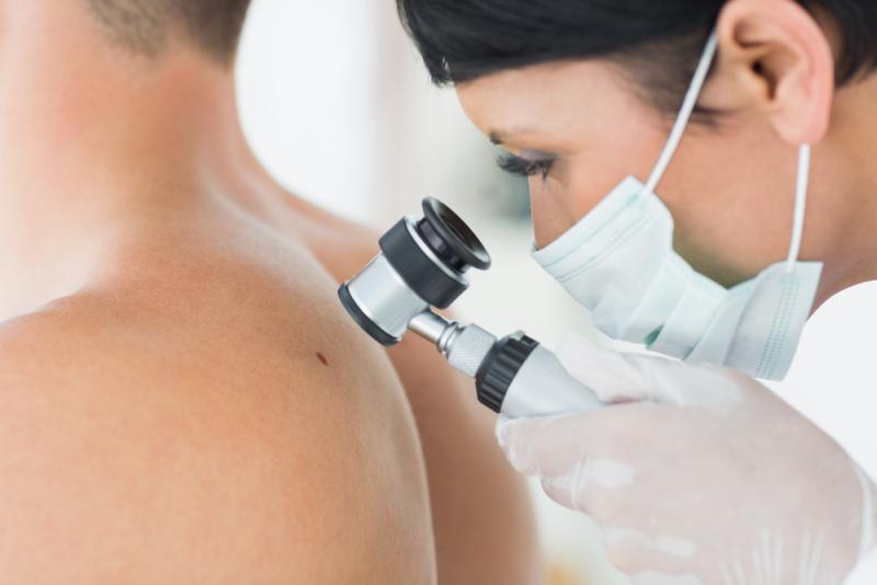 Un ordinateur a été meilleur que des dermatologues pour repérer les cancers de la peau