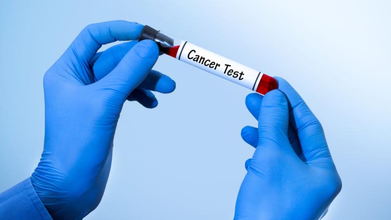 test cancer
