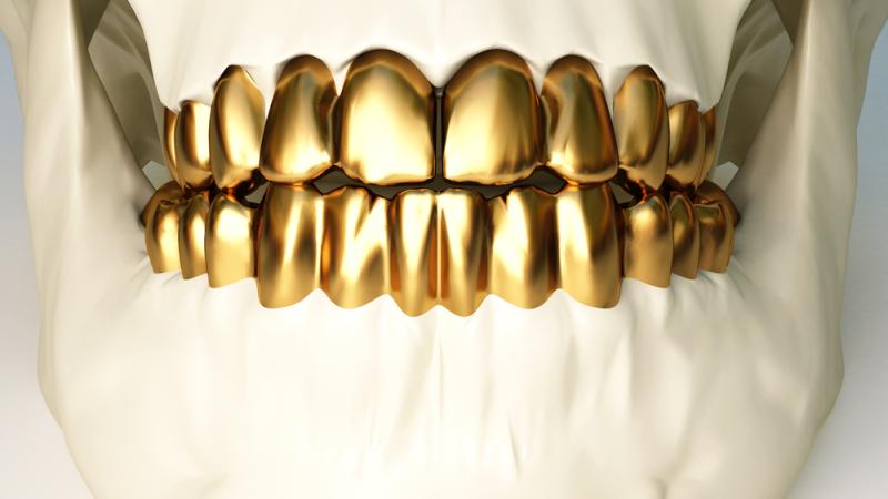 Un homme est soupçonné de voler les dents en or des morts. 