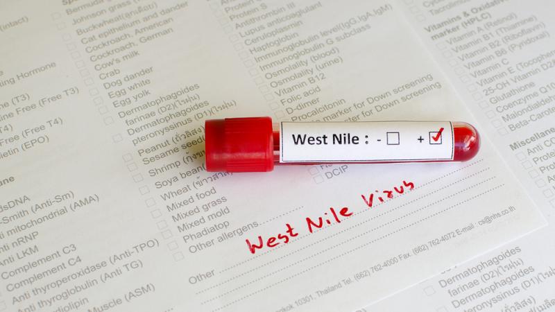 virus du Nil Occidental